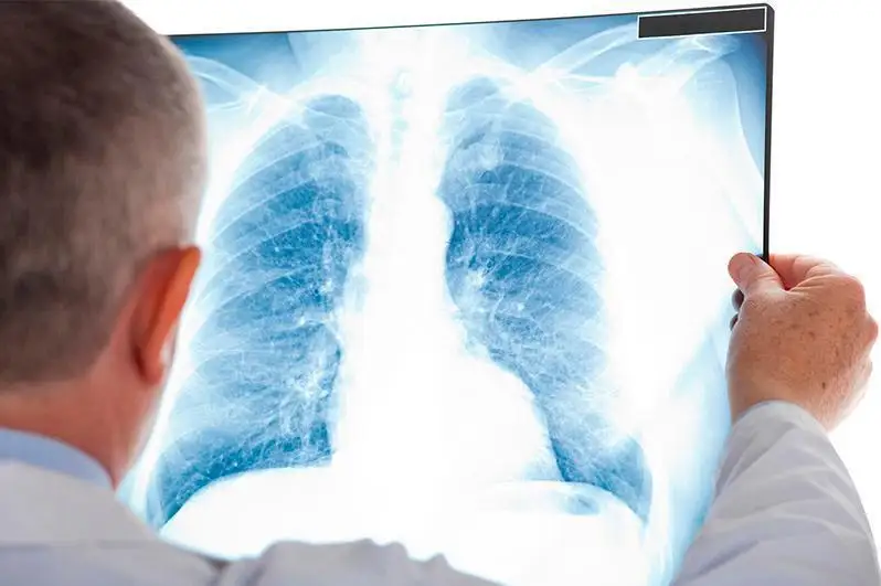 10 казахстанцев заболели пневмонией, четверо скончались