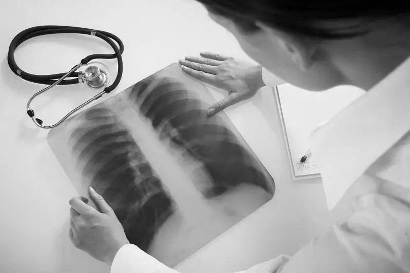 В Казахстане 130 человек заболели пневмонией, один скончался