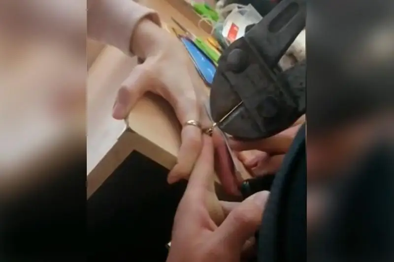 Болторезом снимали кольцо с пальца девушки в СКО