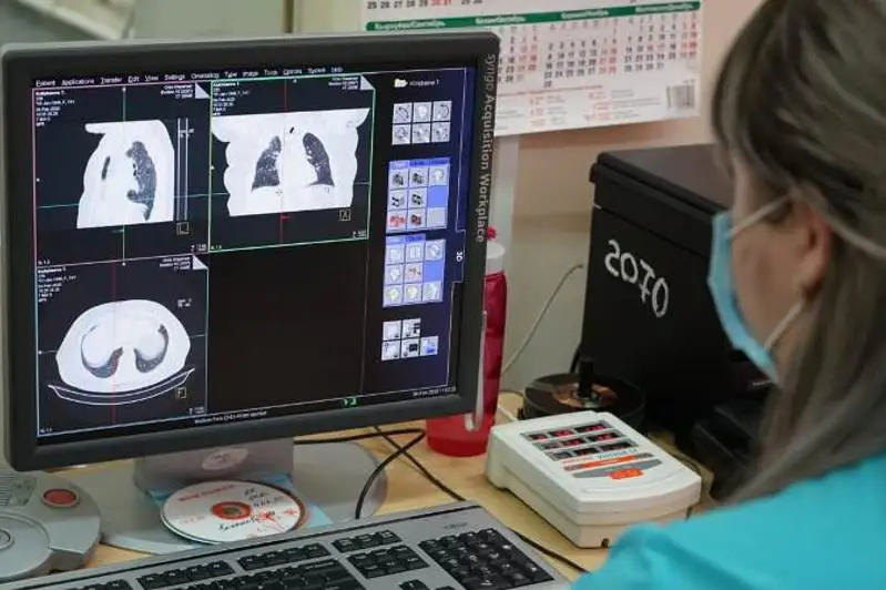 В Казахстане совершенствуют механизм выявления онкологических заболеваний