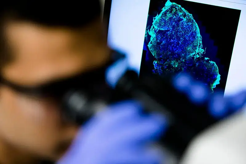 Ранняя диагностика рака позволяет прожить больше - онколог