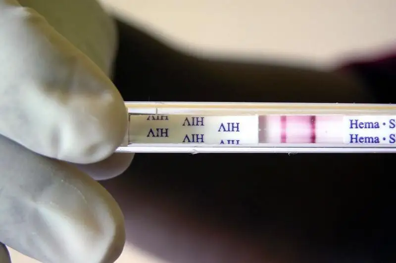 До пяти лет грозит акмолинке, заразившей ВИЧ-инфекцией своего друга