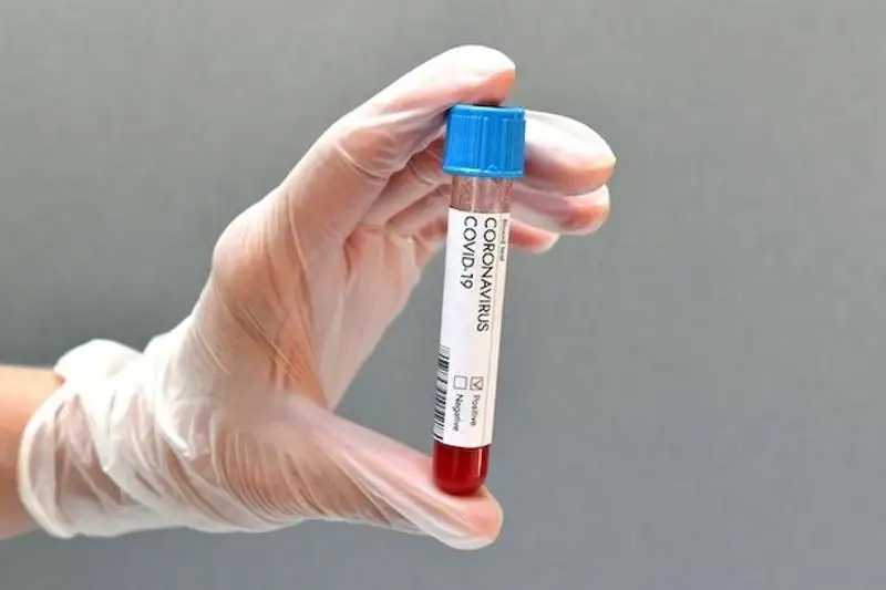 Коронавирус в мире: новая мутация снижает эффективность вакцин в 10 раз