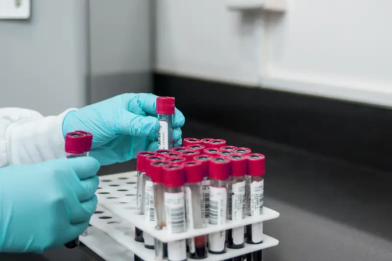 О ситуации с распространением коронавируса сообщили в Атырау