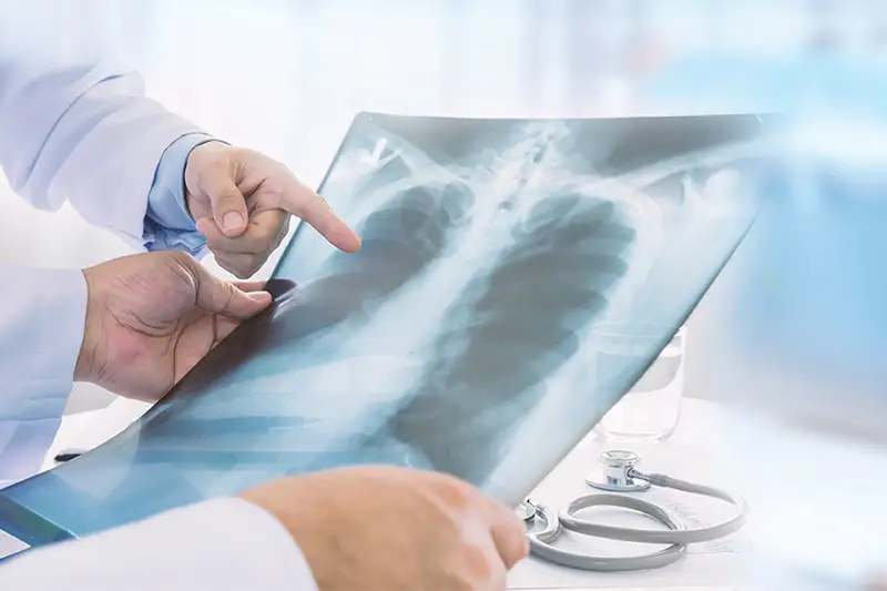 Пневмония с признаками коронавируса: выявлено пять случаев заболевания за сутки