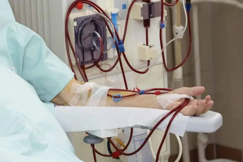 Гемодиализный центр появится в Северо-Казахстанской области