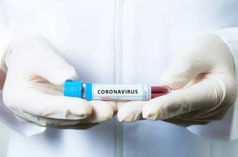 Рост заболеваемости COVID-19 отмечается в Ташкенте