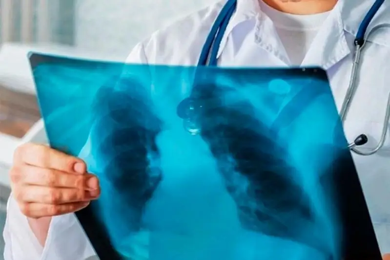 Мужчину с пересаженной почкой и 90% поражением легких вылечили от КВИ в Алматы