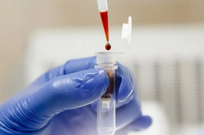 Число смертельных исходов от коронавируса в Украине превысило 25 тысяч