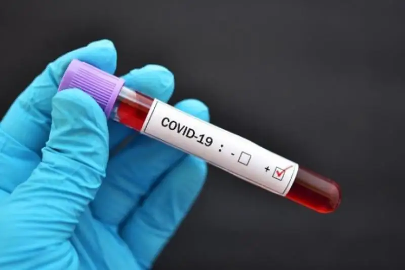 У прилетевшего из Стамбула казахстанца выявлен коронавирус