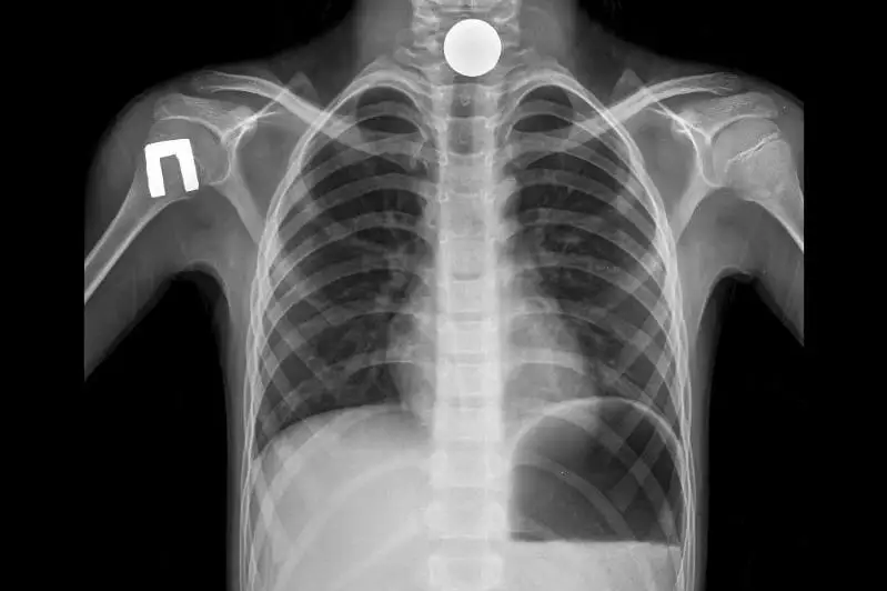 Óńeshine tıyn turyp qalǵan 9 jasar tarazdyq bala qutqaryldy