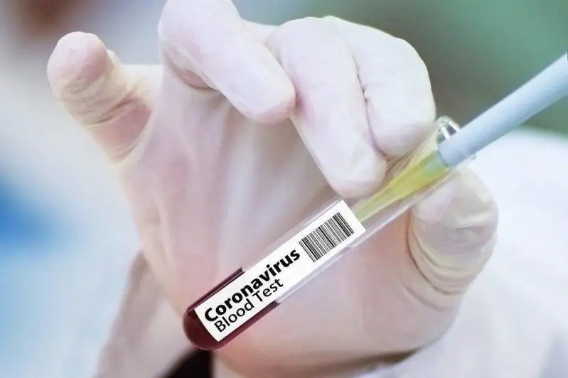 Елімізде коронавирус жұқтырғандар саны 854 мыңнан асты