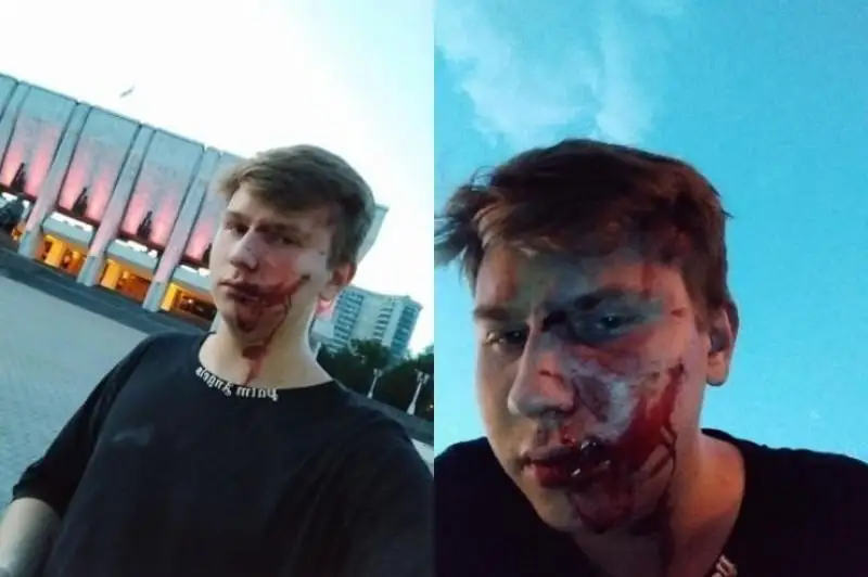 Belgisiz bireýler blogerdi sabap, tonap ketti