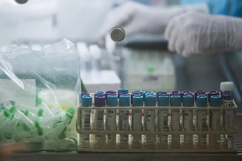 Qyzylorda vırýsologııa zerthanasy zamanaýı jabdyqtarmen tolyqty
