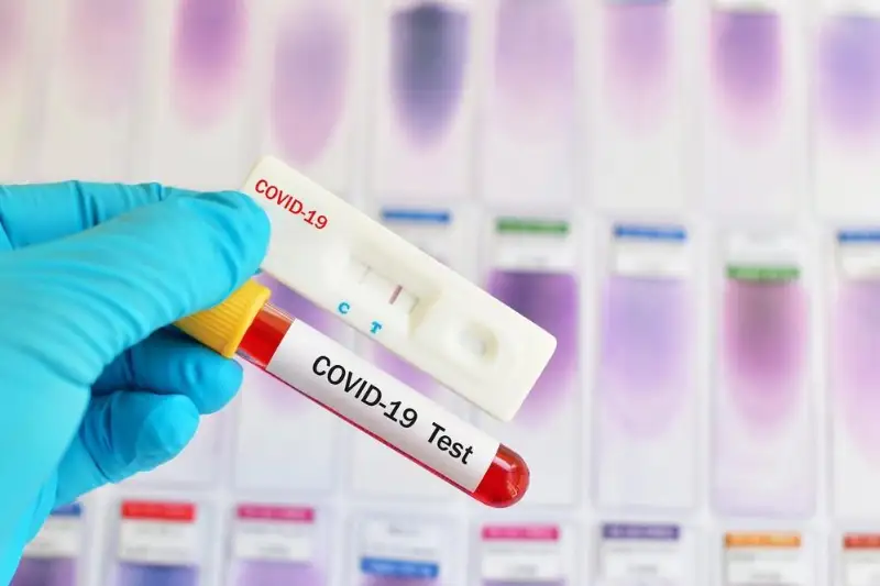 Qazaqstanda koronavırýsty anyqtaýǵa arnalǵan jedel-test baǵasy qansha bolady