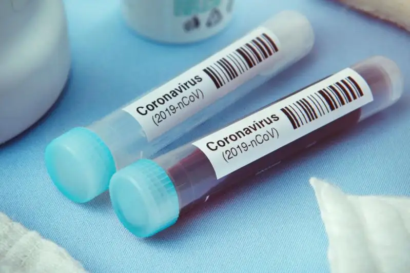 Koronavırýstan kóz jumǵan áıelmen baılanysta bolǵandardyń test nátıjesi jarııalandy
