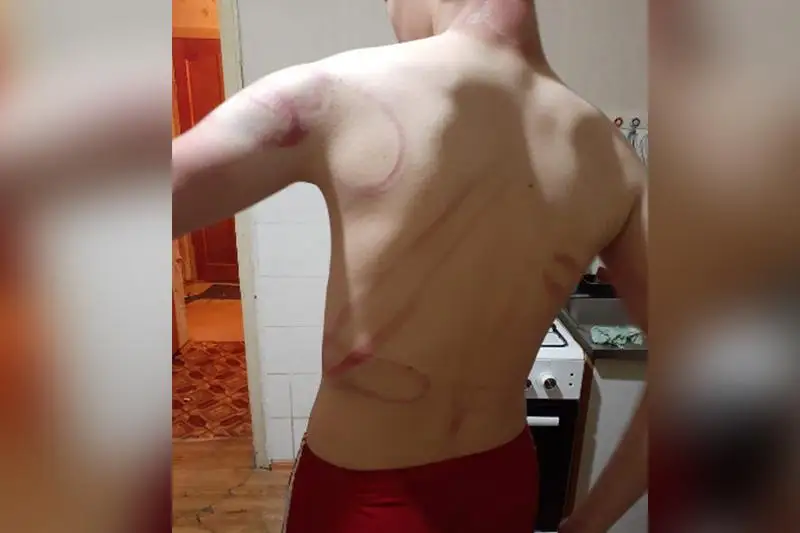 Қапшағайда соққыға жығылған оқушылардың ата-аналары әділдік іздеуде