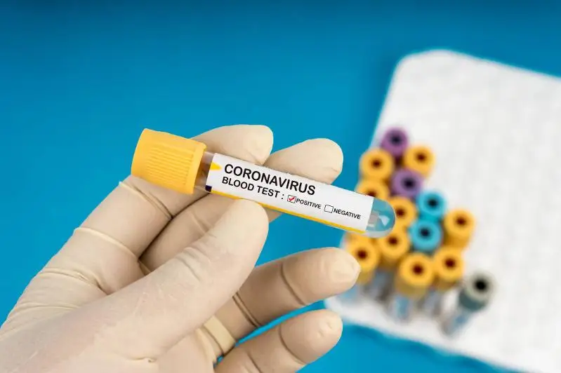 Соңғы тәулікте 76 адамнан коронавирус инфекциясы табылды