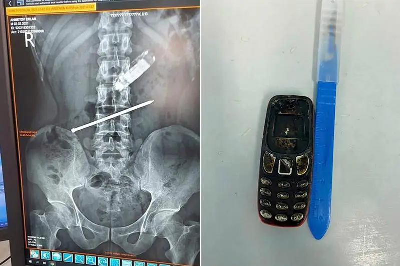 Qyzylordada dárigerler telefon jutyp qoıǵan er adamdy qutqaryp qaldy