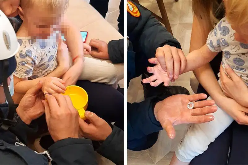 Из металлической шайбы извлекли палец ребенка спасатели СКО