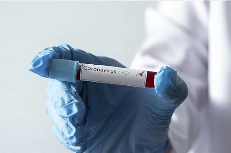 Число случаев заражения коронавирусом в Армении превысило 145 тысяч