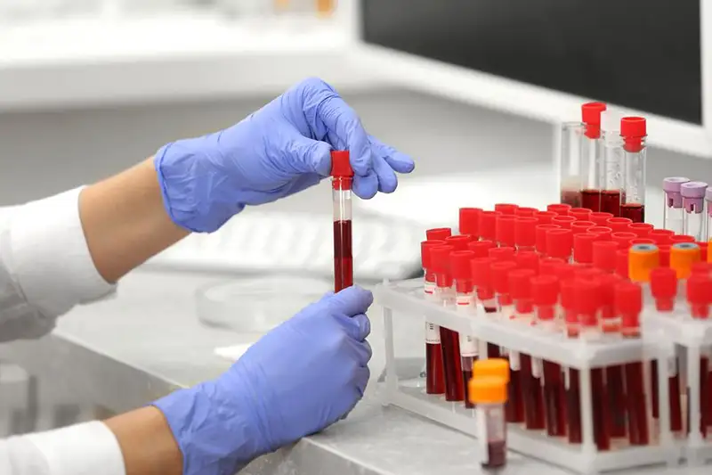 Коронавирус в РК: Забор анализов у всех прибывающих проводят в Казахстане