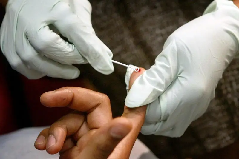 Казахстан относится к странам с низким уровнем распространенности ВИЧ – Минздрав