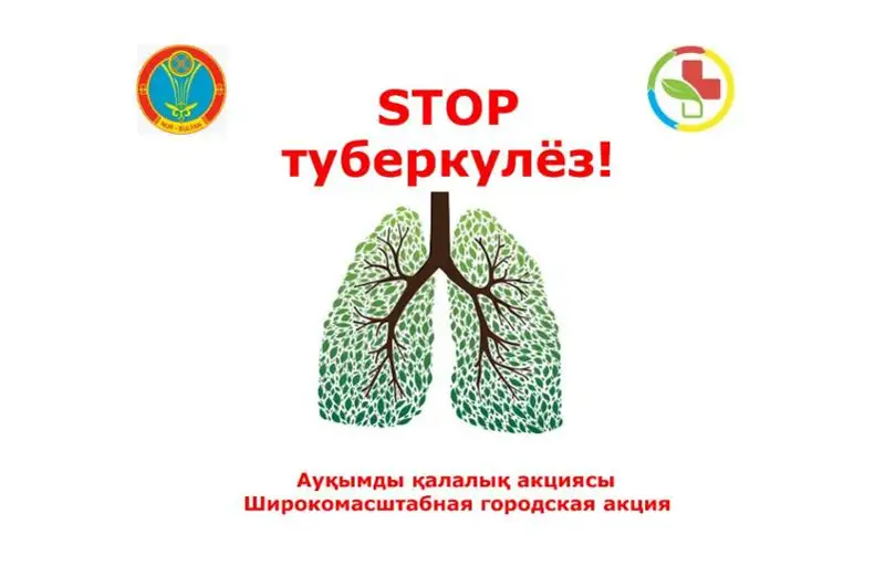 Широкомасштабная акция «Стоп туберкулез!» пройдет в столице