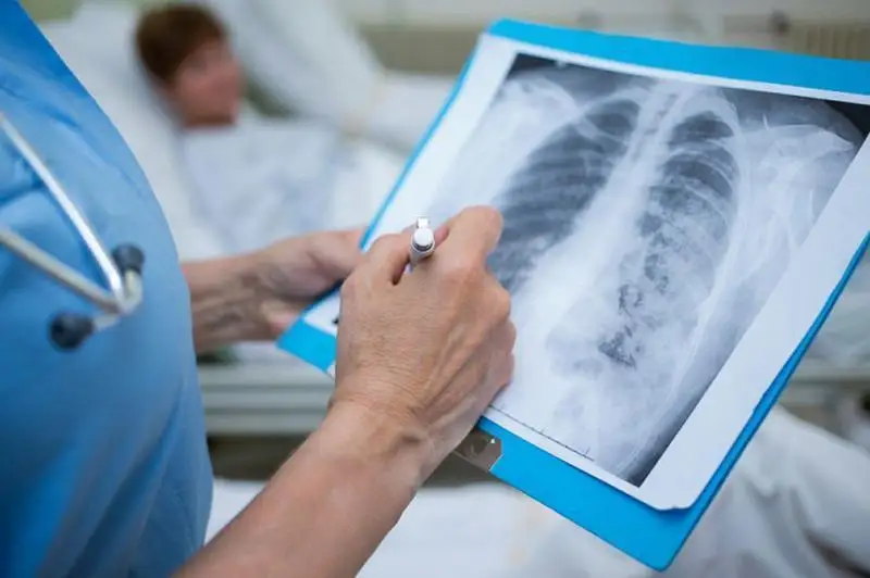 Бессимптомного носителя коронавируса выявили в Синьцзяне