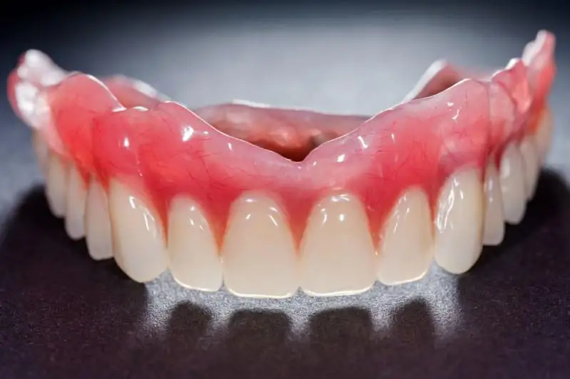 Алматинские врачи спасли жизнь подавившейся зубным протезом пенсионерке