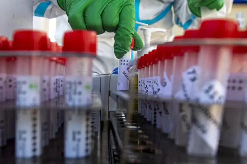 Число зарегистрированных случаев коронавируса превысило 450 тысяч в Украине