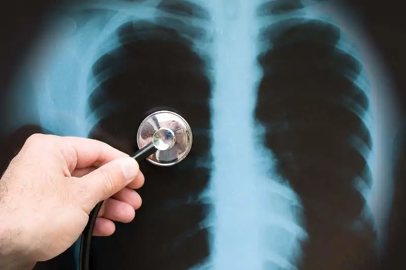 Китай назвал причины вирусной пневмонии