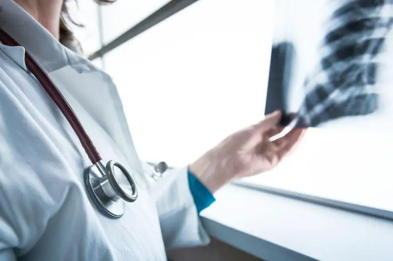 70% семейчан входят в группу риска по туберкулезу