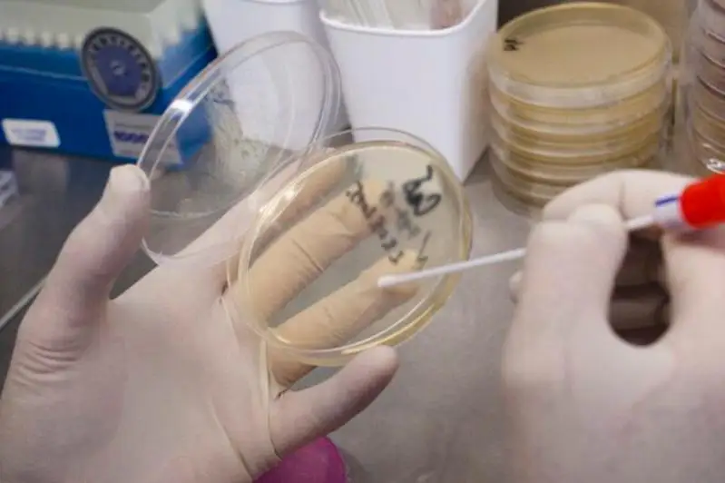 Смывы на патогенную флору из общественного транспорта делают в СКО