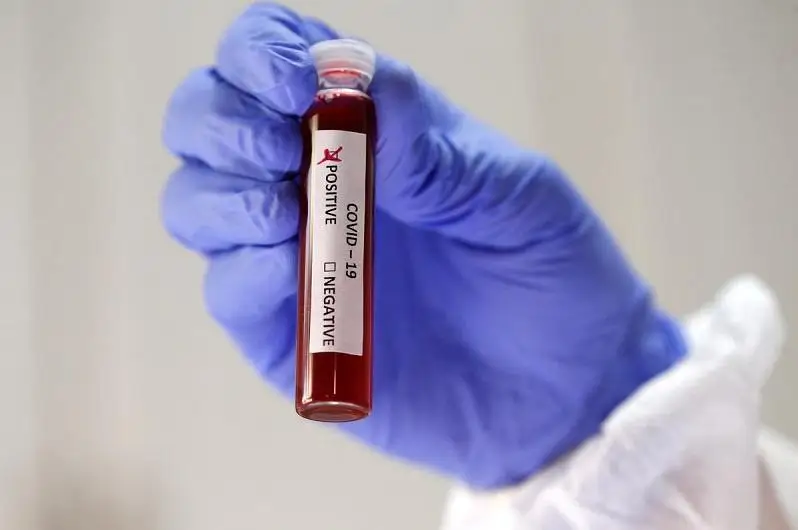 56 новых случаев коронавируса зарегистрировано в Карагандинской области