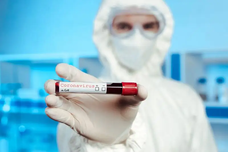 Почти 4,75 млн жителей округа Кашгар СУАР проверили на коронавирус