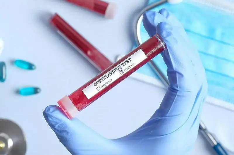 Увеличилось число заразившихся коронавирусом в Актюбинской области