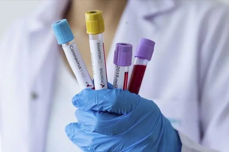 Общее количество случаев заражения COVID-19 в мире превысило 1,3 млн человек