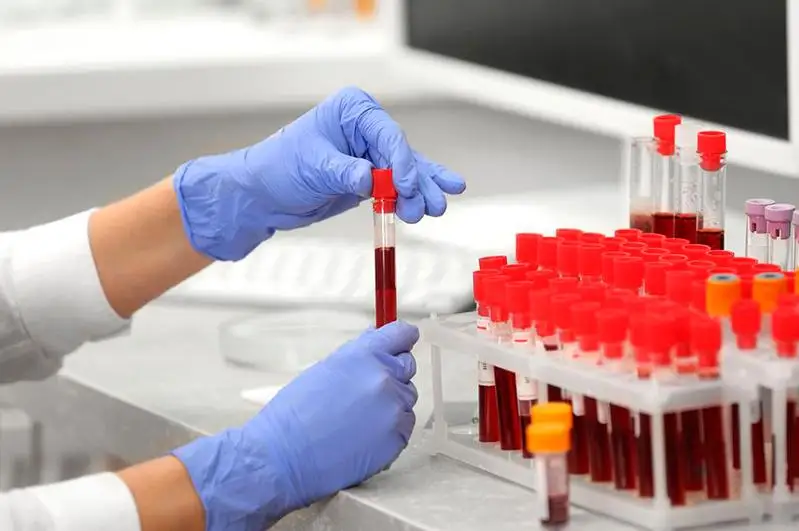 В Узбекистане количество больных коронавирусом достигло 298