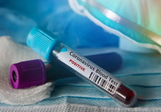 Коронавирус: школы, театры и музеи будут закрыты в Армении до 23 марта