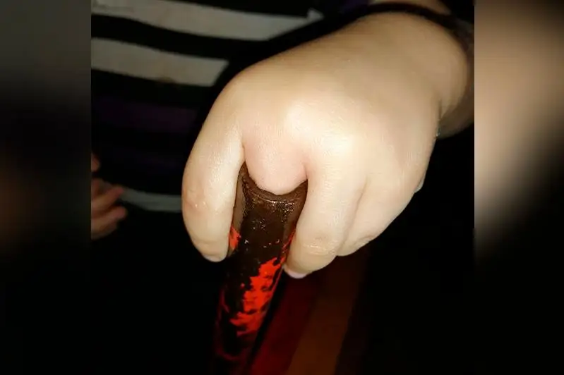 Спасатели в Сарани помогли 3-летнему ребенку освободить застрявший в ножке стула палец