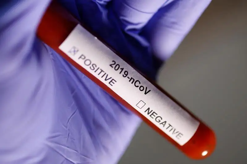 Число заболевших коронавирусом в  Атырауской области достигло 923 человек