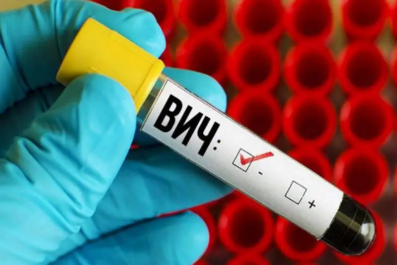 290 млн тенге потратили на  борьбу с ВИЧ-инфекцией в СКО