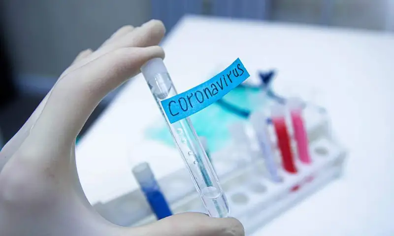 В Казахстане в сутки проводят 30 тысяч тестов на коронавирус