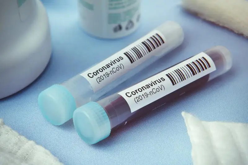 Житель Павлодарской области госпитализирован по подозрению на коронавирус: диагноз не подтвержден