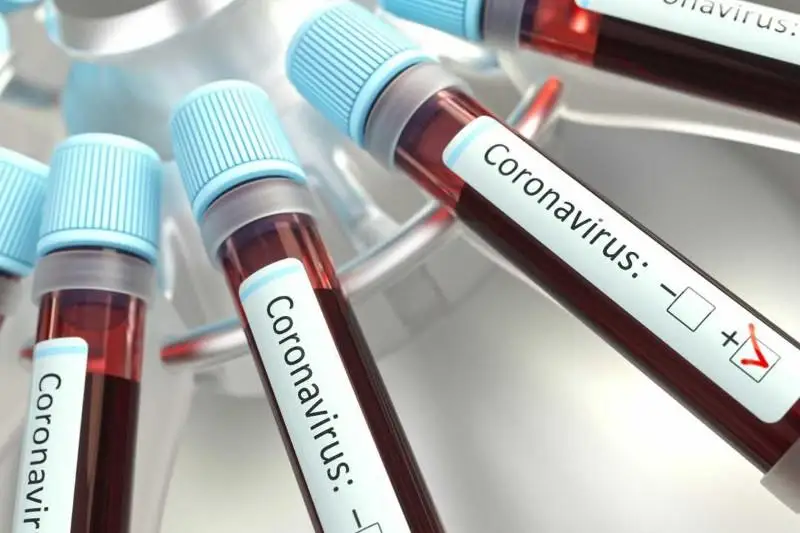 О новом случае COVID-2019 в Жамбылской области