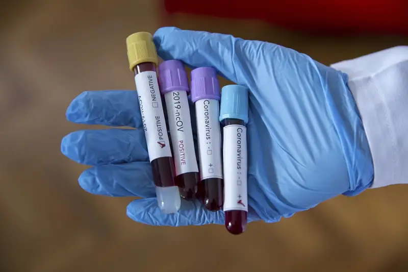 591 случай заболевания коронавирусом выявлен в Казахстане за сутки