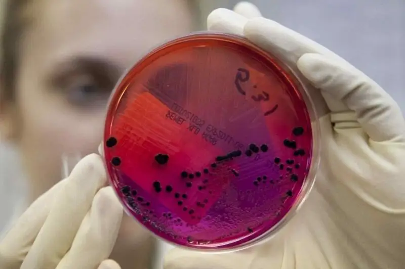 В Алматы выявлены еще три зоны очага коронавирусной инфекции