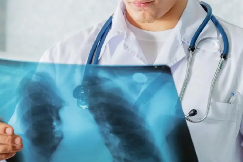 Почти вдвое снизилась заболеваемость туберкулезом в Балхашском регионе