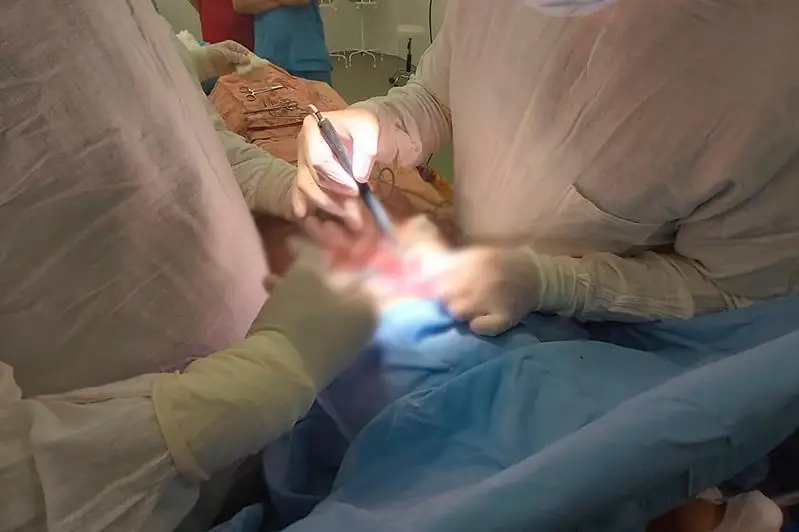 Более килограмма волос извлекли из желудка 13-летней девочки жамбылские медики